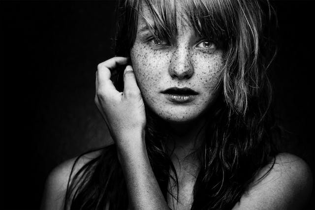 productos-para-evitar-acne-en-el-rostro-class-gold