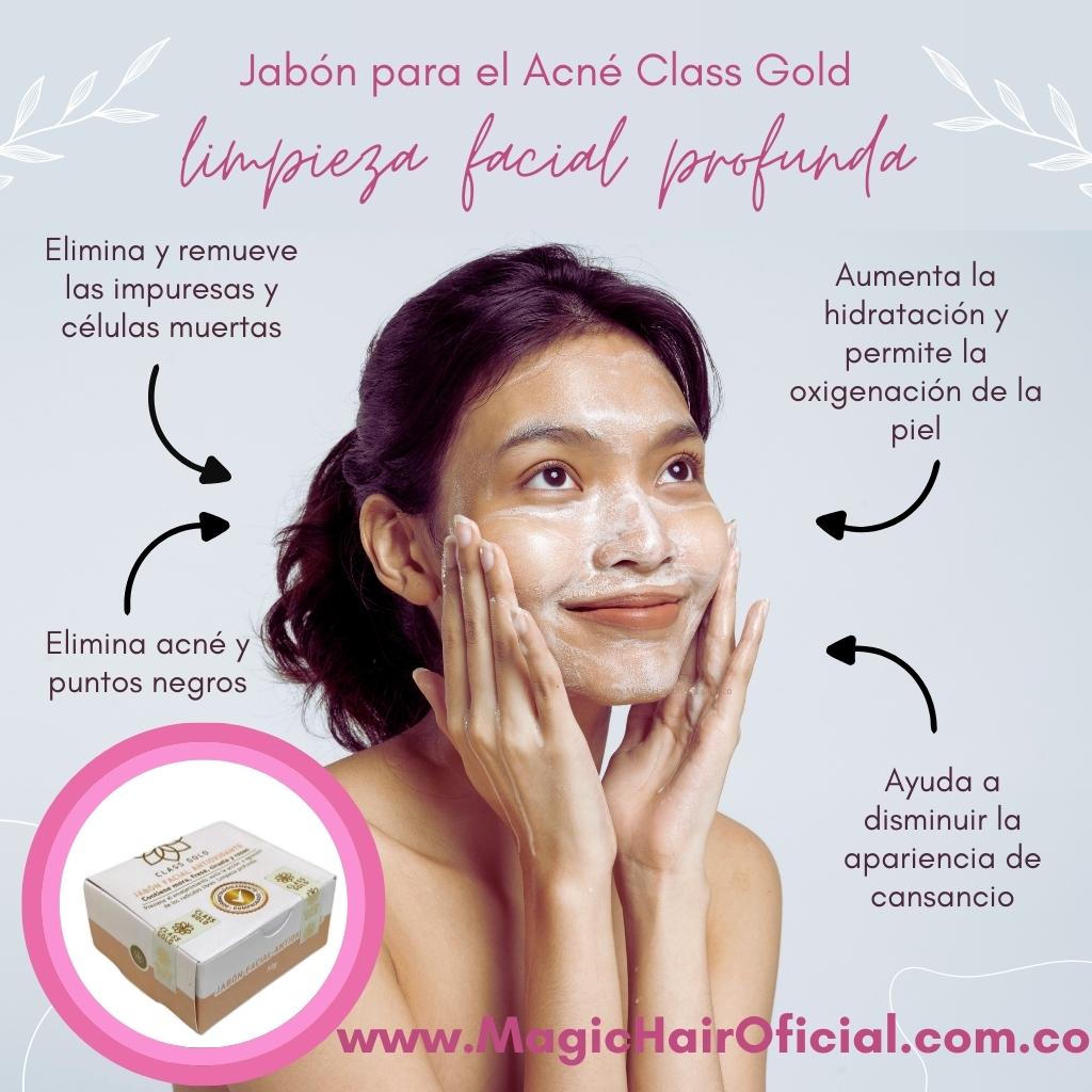 Jabón para el Acné Piel Grasa | Class Gold - Magic Hair