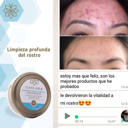 Kit Limpiador Facial | Class Gold | ClassGold Kit Class Gold Magic Hair Oficial