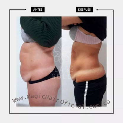 Gel Reductor de Abdomen | Class Gold