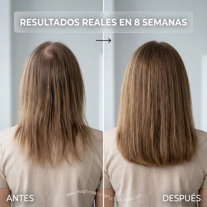 Kit Shampoo Para La Caida Del Cabello Con Ginseng En Cabello Fino 2 Unds