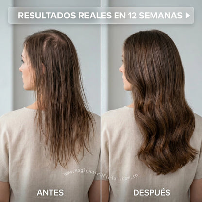 Kit Biotina y Colágeno + Shampoo Crecimiento Acelerado para Cabello Débil