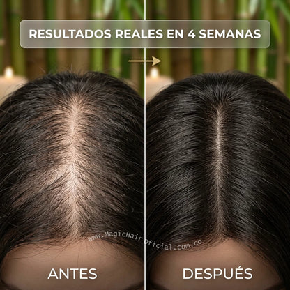 Kit Crecimiento Capilar con Biotina 6 Productos | Magic Hair