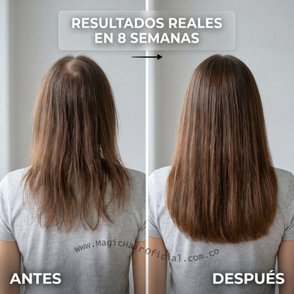 Kit Shampoo Crecimiento Acelerado Y Capilmax Para Cabello Fino 1000ml