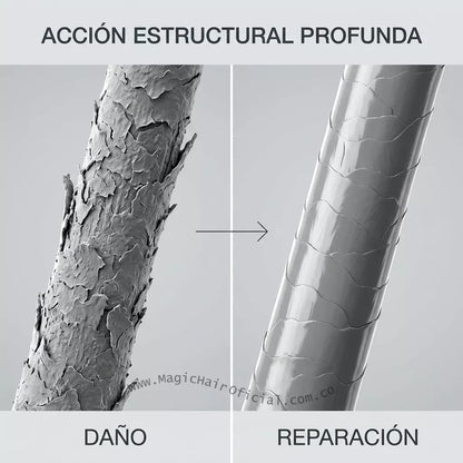 Kit Shampoo Crecimiento Acelerado Y Anticaída Cabello Débil 1500ml