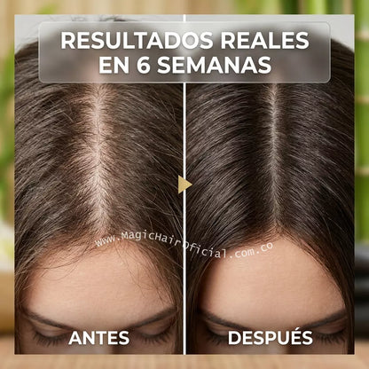 Kit Tratamiento Repolarizador Intensivo Para Cabello Seco