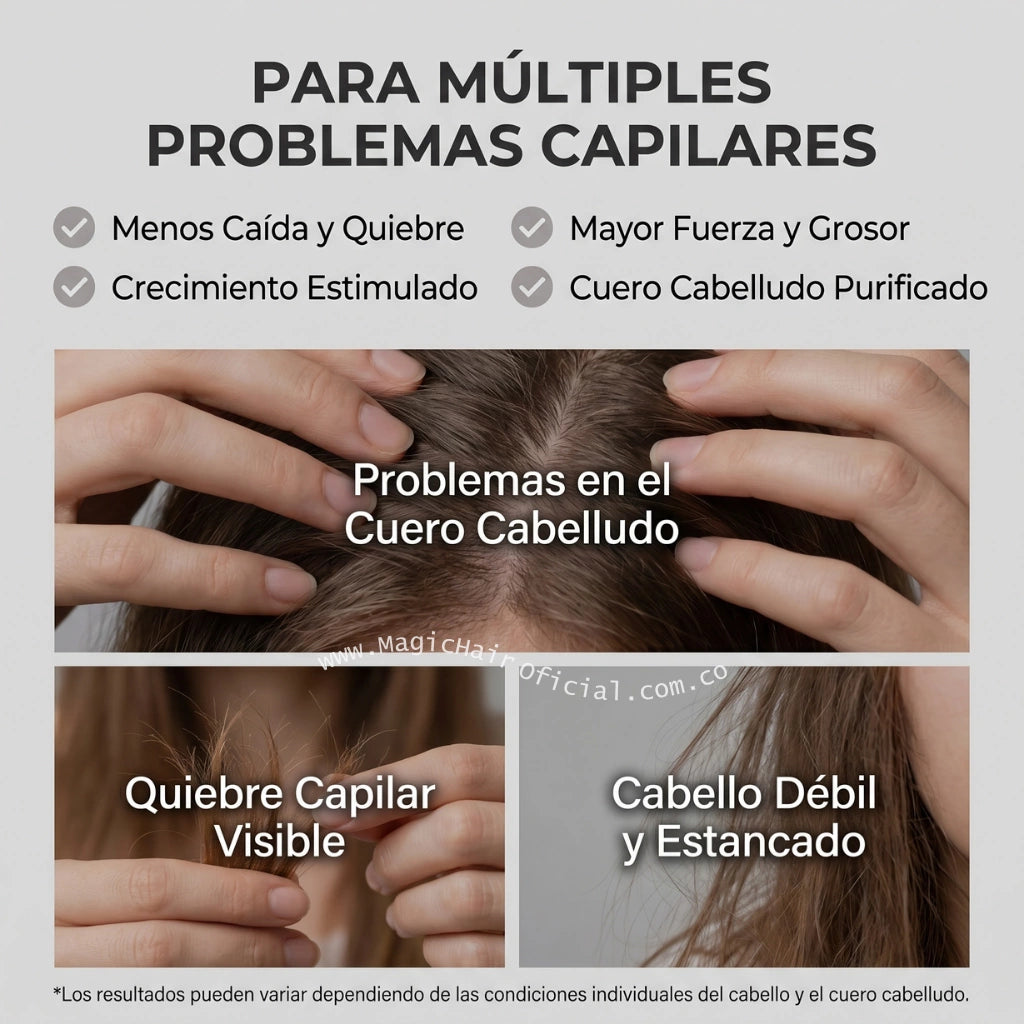 Kit con shampoo de romero para frenar el quiebre, caída y cabello estancado magic hair oficial medellin
