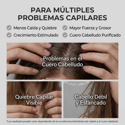 Kit con shampoo de romero para frenar el quiebre, caída y cabello estancado magic hair oficial medellin