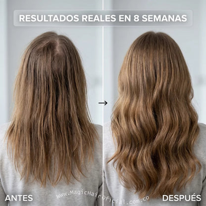 Kit Shampoo Crecimiento Acelerado Anticaída Para Cabello Fino 1500ml
