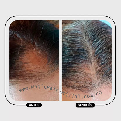 Tonico Capilar para la Caida del Cabello | Magic Hair