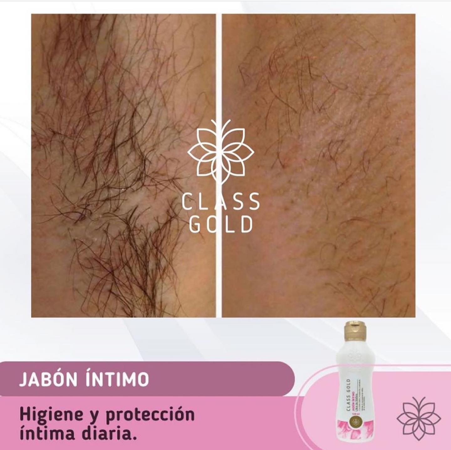 Jabon Intimo | Class Gold Jabón Íntimo Class Gold Magic Hair Oficial