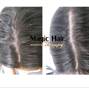 Shampoo Anticaspa Cabello Natural sin Sal | Magic Hair | Magia en tu Cabello Shampoo Magic Hair Magic Hair Oficial