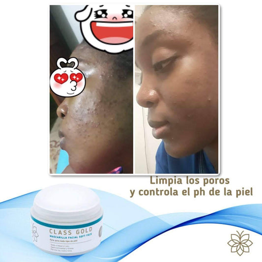 Kit Anti Acné | Class Gold  | ClassGold Kit Class Gold Magic Hair Oficial