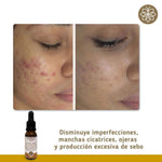 Kit Limpiador Facial + Jabón | Class Gold  | ClassGold Kit Class Gold Magic Hair Oficial