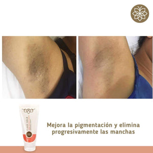Kit Íntimo 2 Productos | Class Gold Kit Class Gold Magic Hair Oficial
