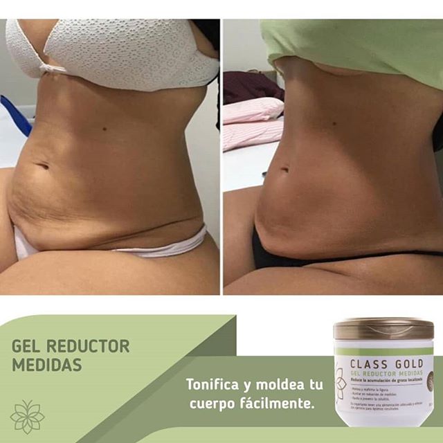 Gel Reductor Anticelulitis + Papel Osmótico Yodado Kit Class Gold Magic Hair Oficial