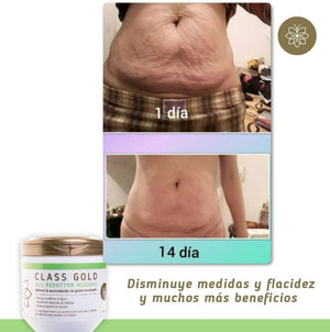 Gel Reductor Anticelulitis + Papel Osmótico Yodado Kit Class Gold Magic Hair Oficial