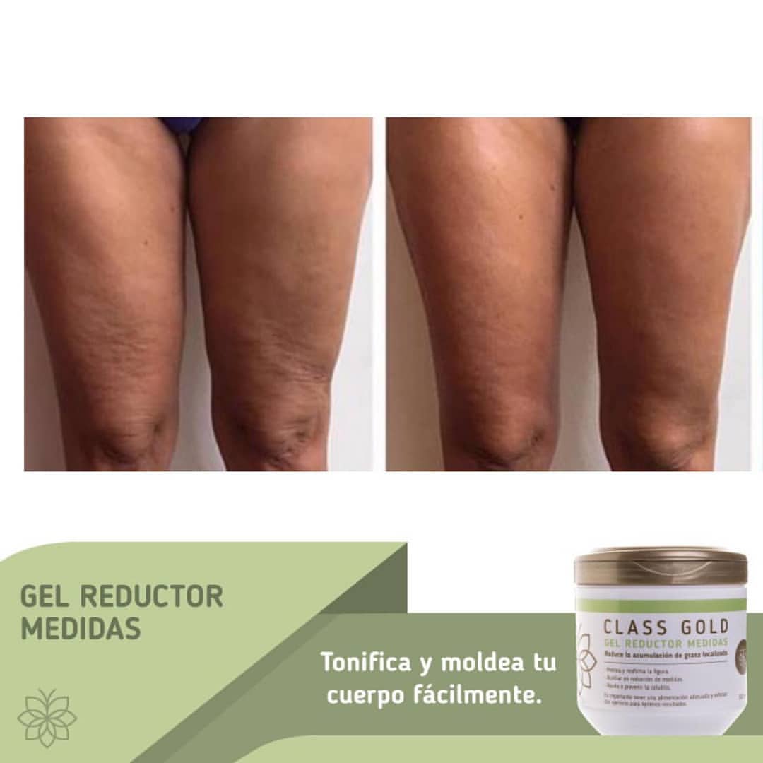 Gel Reductor Anticelulitis + Papel Osmótico Yodado Kit Class Gold Magic Hair Oficial
