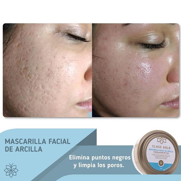 Mascarilla Facial de Arcilla | Class Gold Mascarilla Class Gold Magic Hair Oficial