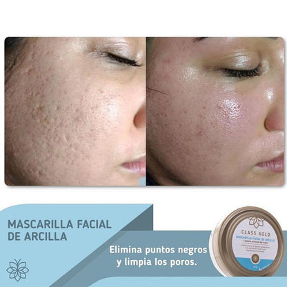 Mascarilla Facial de Arcilla | Class Gold Mascarilla Class Gold Magic Hair Oficial