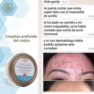 Kit Mascarilla Facial de Arcilla + Mascarilla Soft Face | Class Gold Mascarilla Class Gold Magic Hair Oficial
