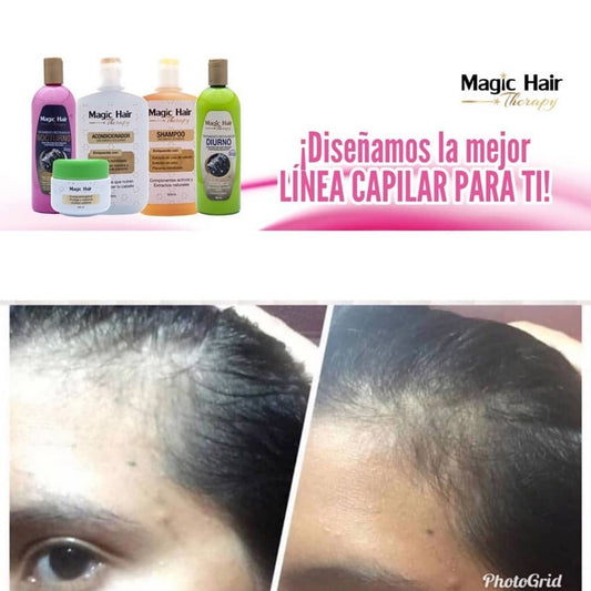 Kit Shampoo Anticaspa Cabello + Tratamiento Nocturno | Magic Hair | Magia en tu Cabello Kit Magic Hair Magic Hair Oficial