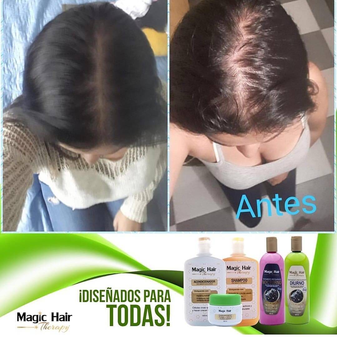 Kit Anticaída Cabello Shampoo + Tratamiento Nocturno | Magic Hair | Magia en tu Cabello Kit Magic Hair Magic Hair Oficial