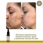 Kit Antimanchas Facial | Class Gold  | ClassGold Kit Class Gold Magic Hair Oficial