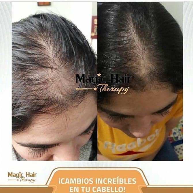Kit Anticaida Cabello Tratamiento Diurno | Magic Hair | Magia en tu Cabello Kit Magic Hair Magic Hair Oficial