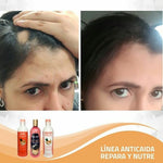Kit Anticaida Cabello Tratamiento Diurno | Magic Hair | Magia en tu Cabello Kit Magic Hair Magic Hair Oficial