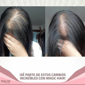 Kit Anticaida Cabello Tratamiento Diurno | Magic Hair | Magia en tu Cabello Kit Magic Hair Magic Hair Oficial
