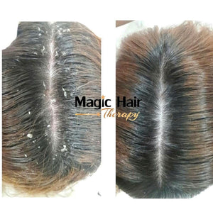 Kit Crecimiento Shampoo y Acondicionador + Shampoo Anticaspa Kit Magic Hair Magic Hair Oficial