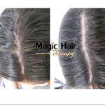 Kit Anticaspa Cabello Platinum + Diurno | Magic Hair | Magia en tu Cabello Kit Magic Hair Magic Hair Oficial